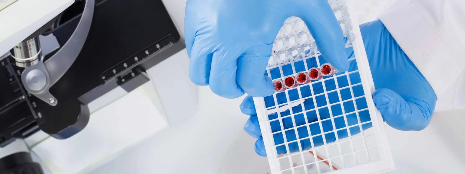 Blue gloved hands holding a 96 well plate with red assay wells next to a microscope, illustrating end to end assay development and high quality data generation at Crystal Bio Solutions.